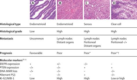 Clinical research in endometrial cancer: consensus .